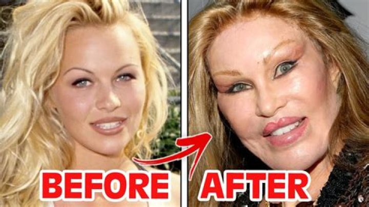 Bling Empire Kim Lee Nose Job With Before And After Plastic Surgery Photos