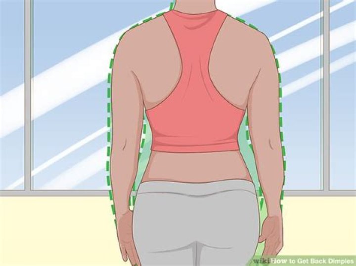 Can you get back dimples through exercise