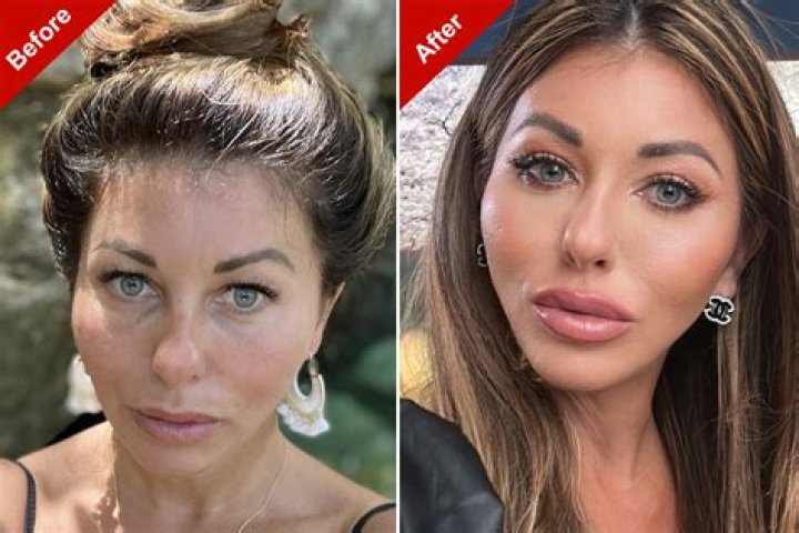 Has Meredith Marks Undergone Plastic Surgery? Face Before And After Photos