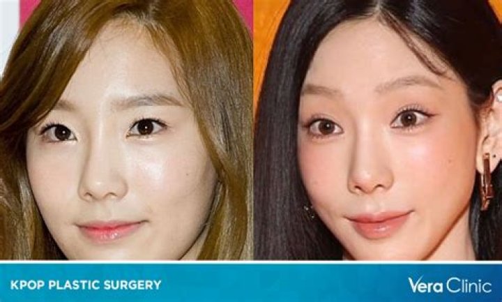 NewJeans Plastic Surgery: The K-Pop Idols Before and After Cosmetic Surgery!