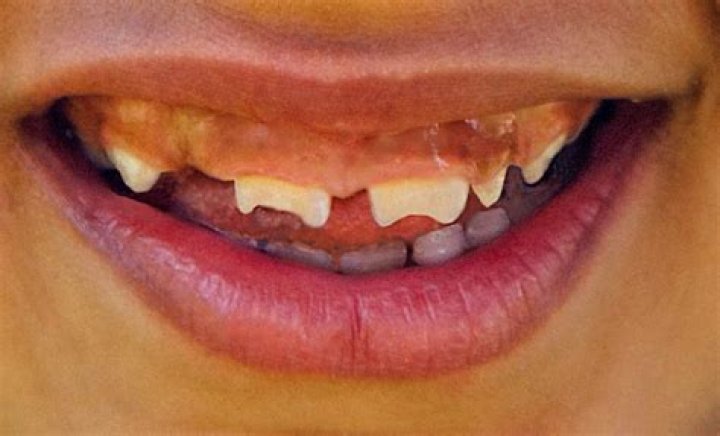 Tay Strathairn Wikipedia Teeth: Facts To Know About Actor